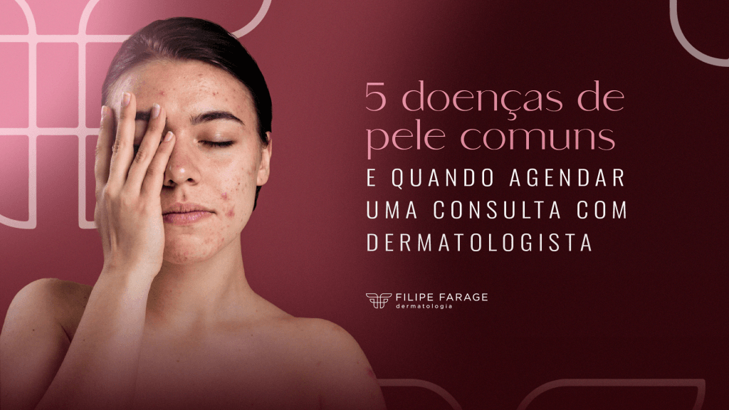 5 doenças de pele comuns e quando agendar uma consulta com dermatologista