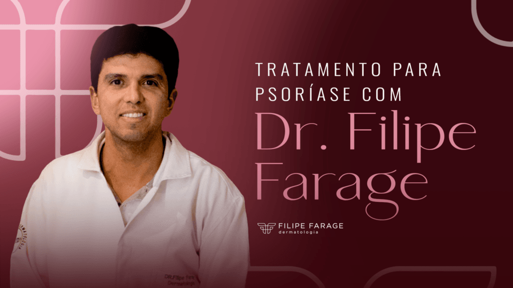 Tratamento para psoríase com o Dr. Filipe Farage