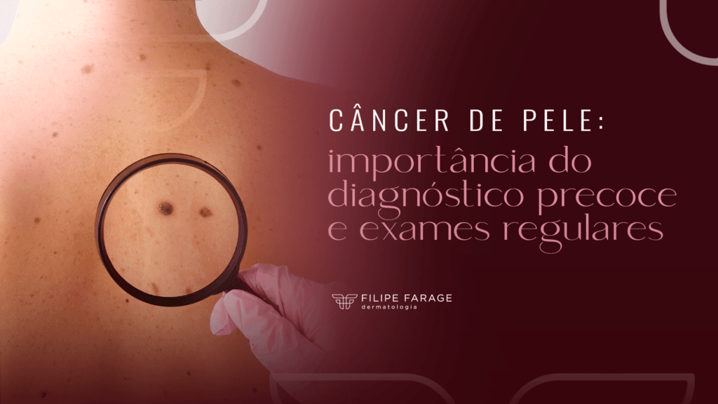 Câncer de Pele: Diagnóstico Precoce e Exames Essenciais