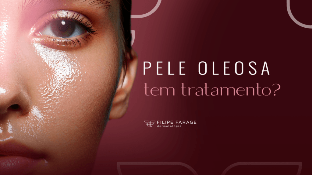 Tratamento Para Pele Oleosa: Saiba o Que Realmente Funciona